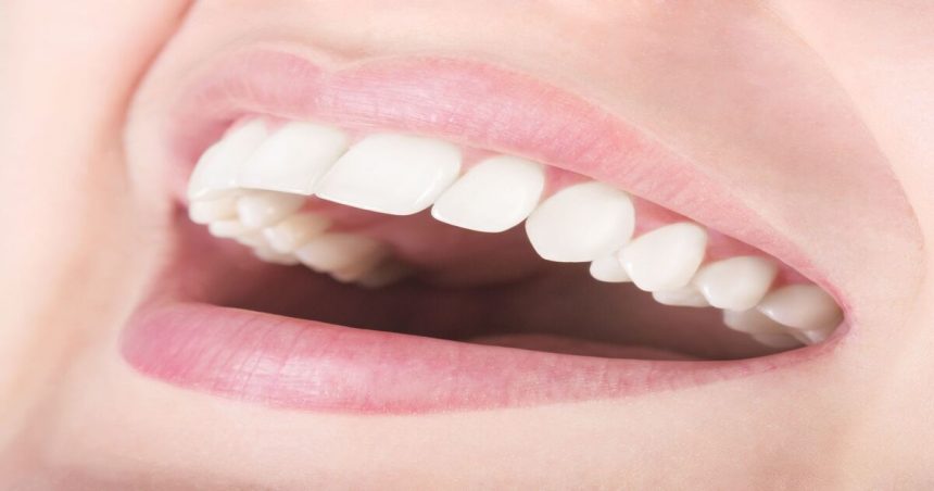 Tips to Get Rid of White Spots on Teeth