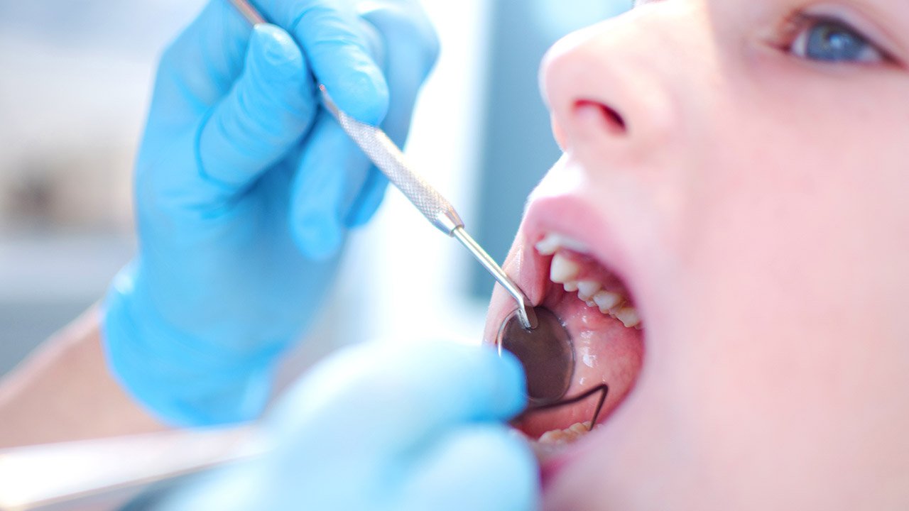 Common dental procedures and how they work￼