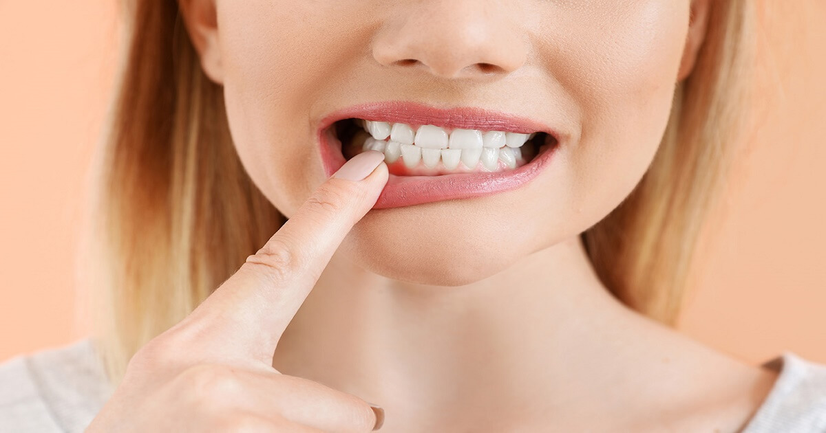 Everything About Gum Diseases